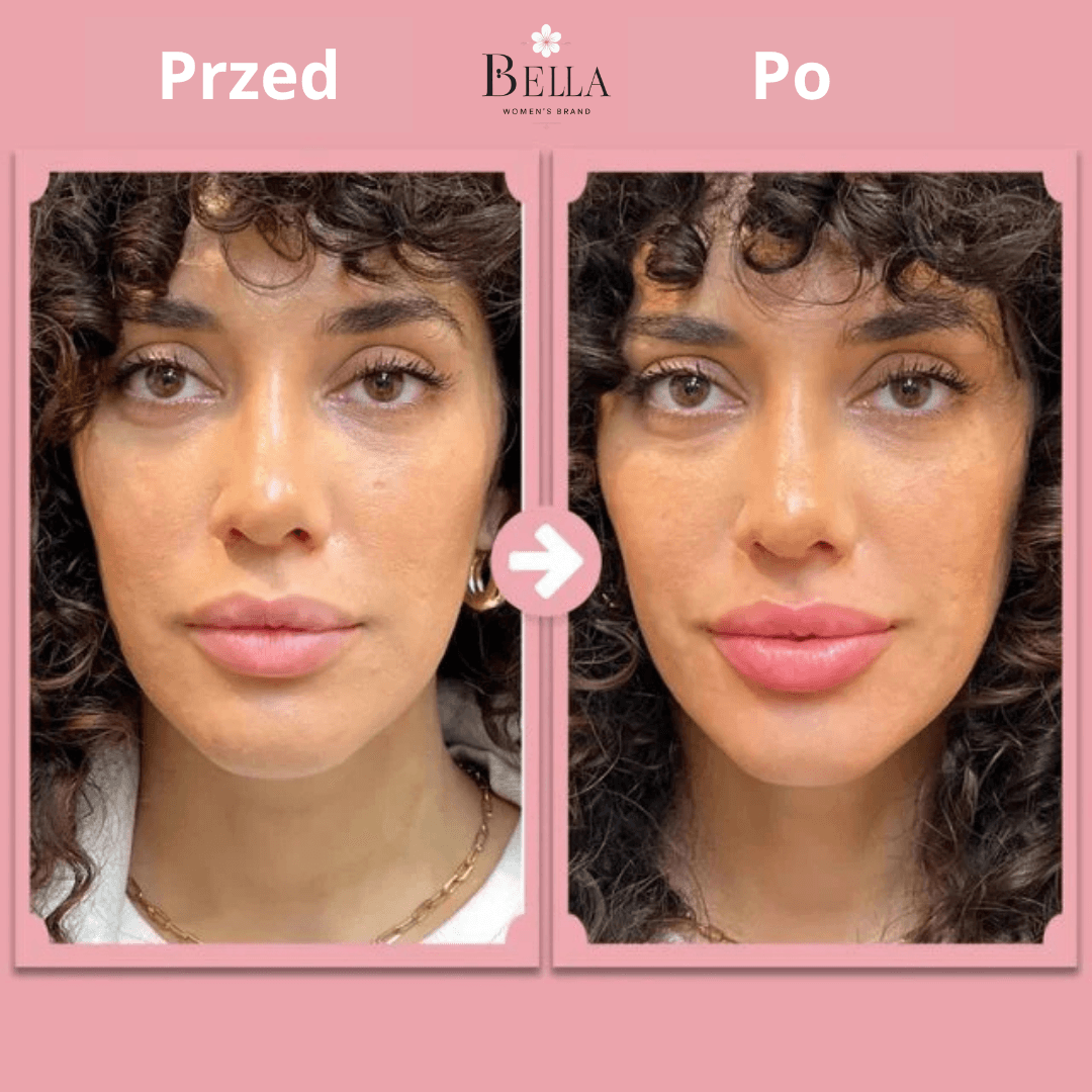 LipBoost - Naturalne powiększenie ust bez zabiegów + Serum z kwasem Hialuronowym GRATIS!